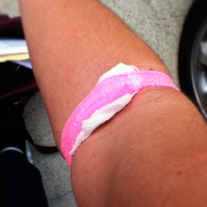 TB testing - round 2 TB testing - round 2